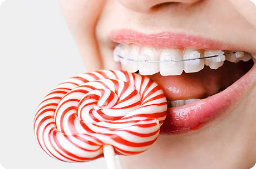 Orthodontiste Poussan 34560