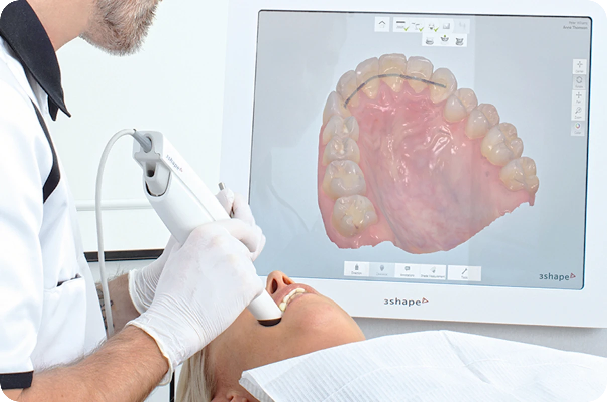 empreinte-numerique-orthodontiste poussan