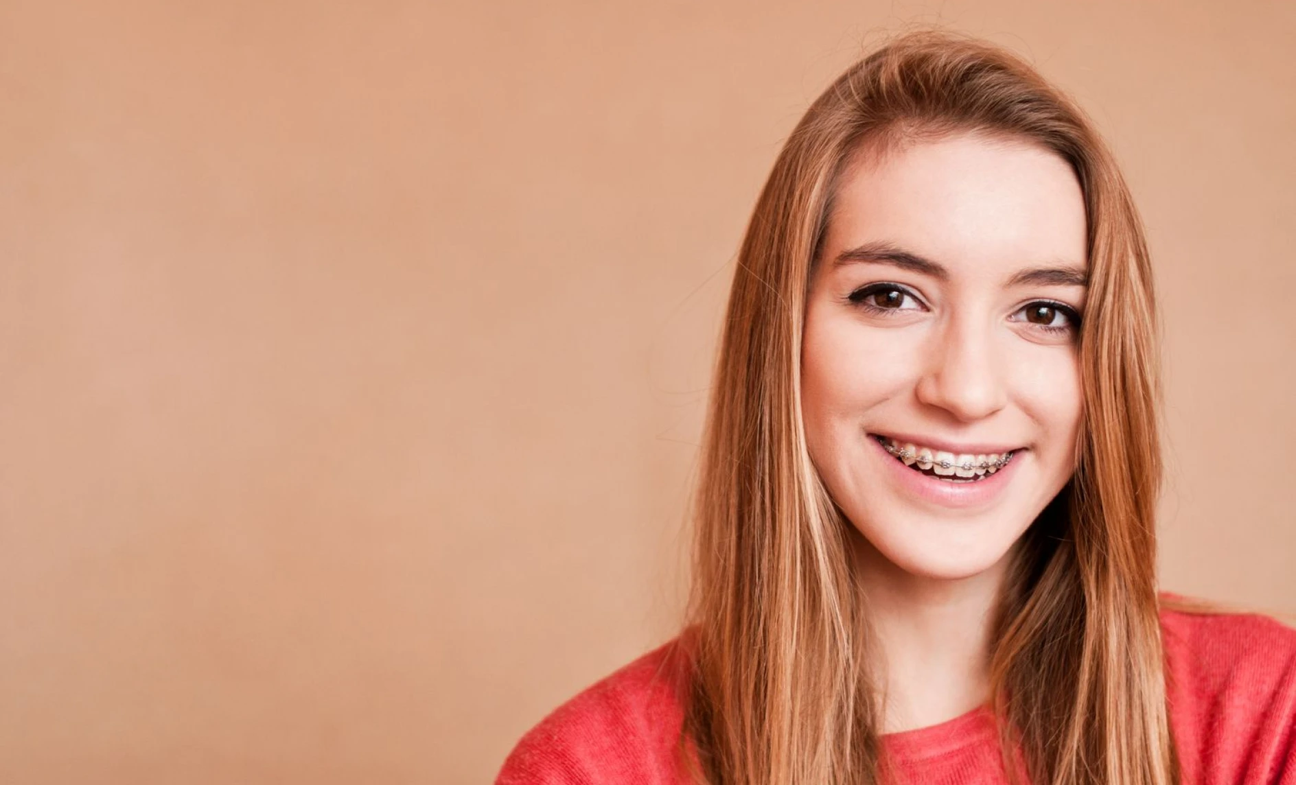 Orthodontie Adolescents à Poussan 34560